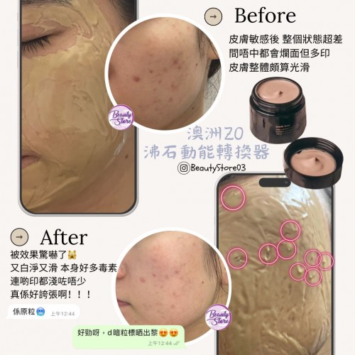 ZO 沸石動能轉換器mask100ml