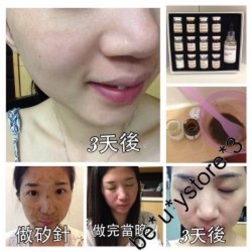 DERMIER RESTING PEEL 海藻矽針 (3款組合) DERMIER RESTING PEEL 海藻矽針 (3款組合)