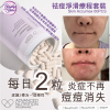 ANP Skin Accumax 袪痘淨滑療程 60粒