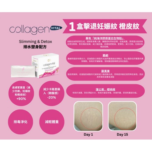 Vita Recherche Collagen Vital 膠原蛋白肽沖劑 (Power10 / Hair / Beauty) (1盒15包) Vita Recherche Collagen Vital 膠原蛋白肽沖劑 (Power10 / Hair / Beauty) (1盒15包)