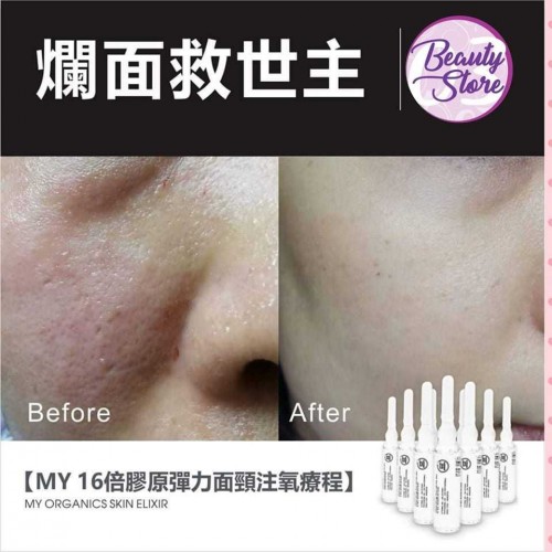 MY 16 倍精華 (1盒 6ml x 12 支)