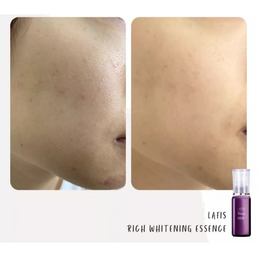 Lafis Rich Whitening Essence 美白精華液 40ml