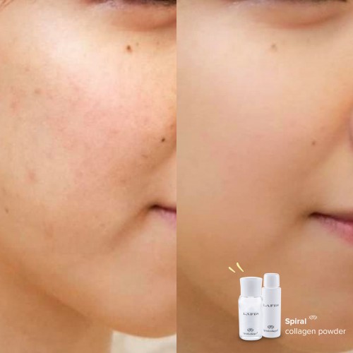 Lafis Spiral Collagen Powder 三重螺旋膠原蛋白精華 30g Lafis Spiral Collagen Powder 三重螺旋膠原蛋白精華 30g