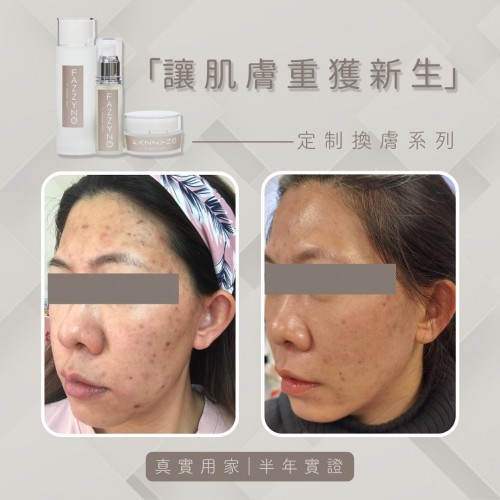 Fazzyno 套裝(3件套) Fazzyno 套裝(3件套)