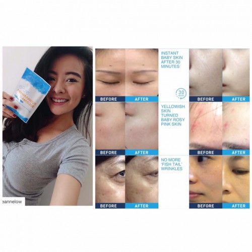 Epure JELLY MASQUE Epure JELLY MASQUE